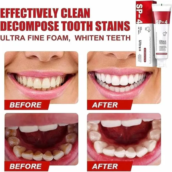 Toothpaste for Gums, Breath & Whitening