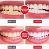 Yayashi Toothpaste with Stain Removing Formula
