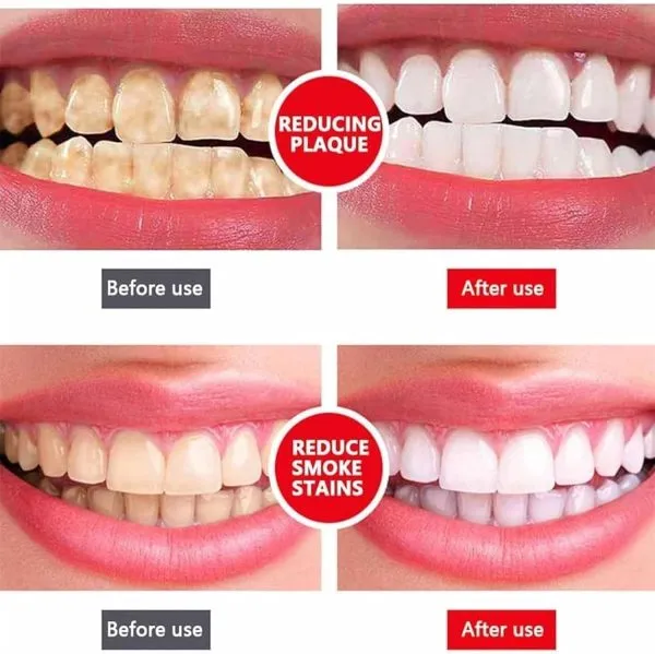 Yayashi Toothpaste with Stain Removing Formula